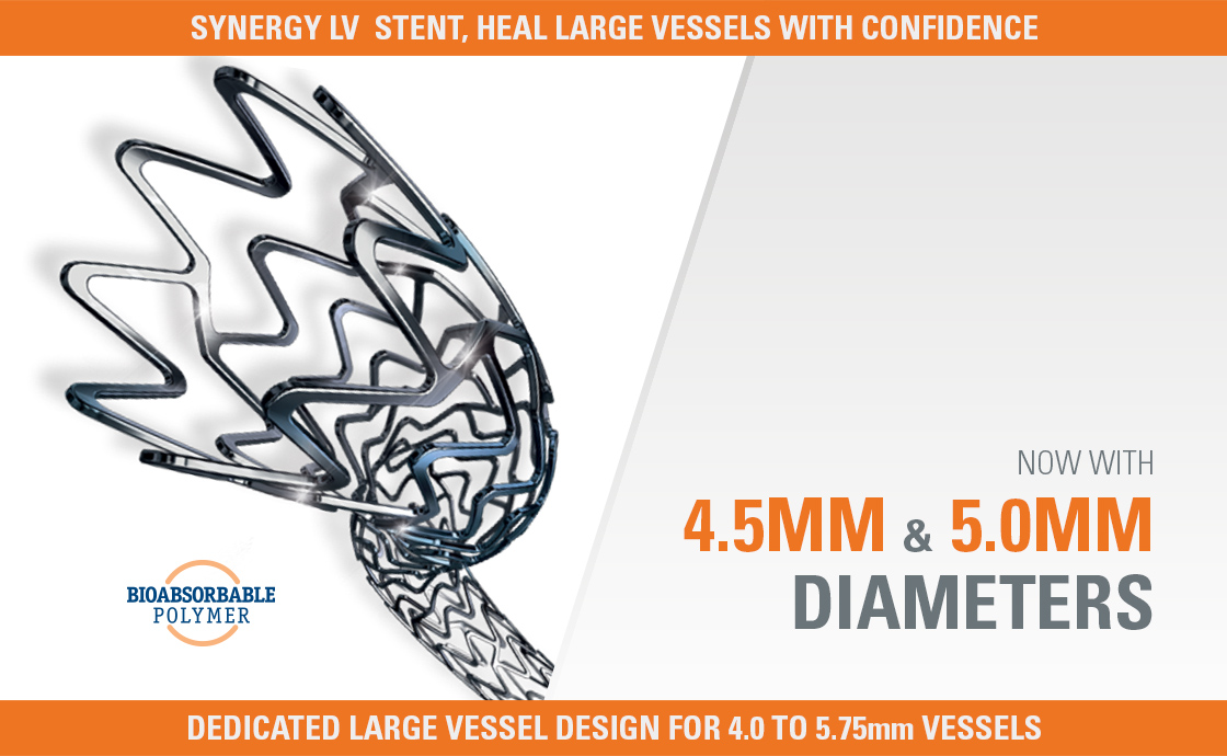 Synergy 4.5mm & 5.0mm
