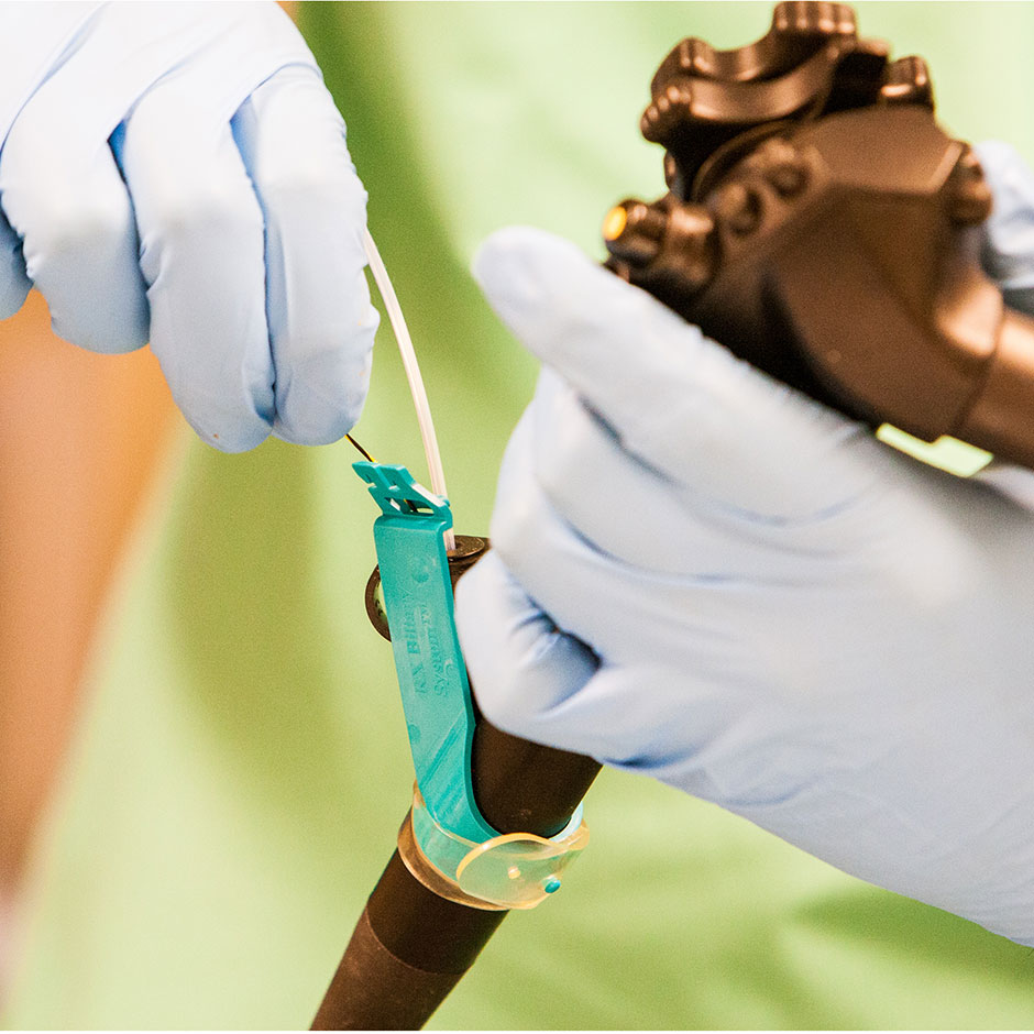 RX Biliary System&trade;