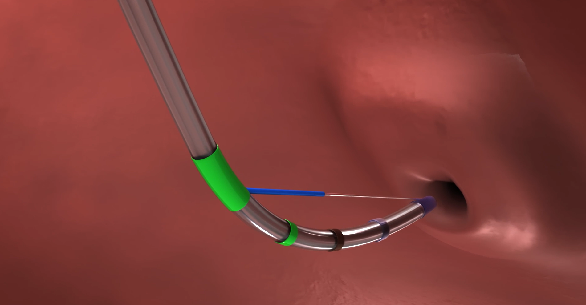 Animation of Autotome Pro RX.