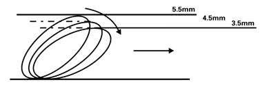 FilterWire EZ System nitinol filter loop