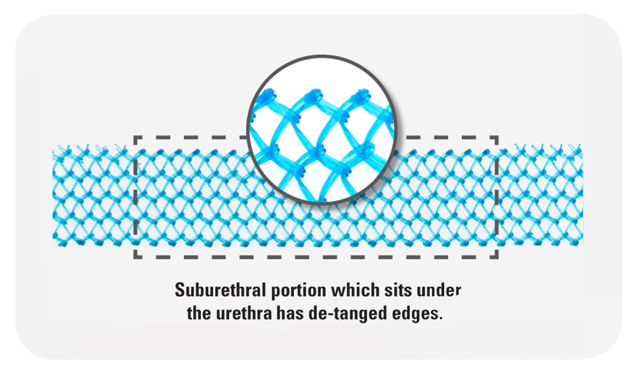 close up view of mesh. Suburethral portion which sits under the urethral has detangles edges.